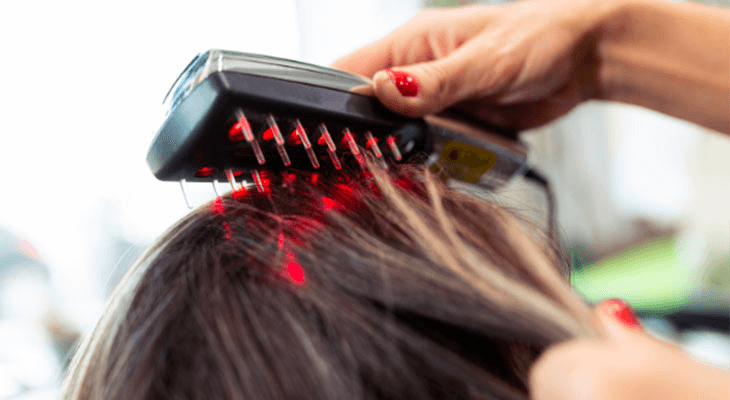 Red light therapy for hair loss