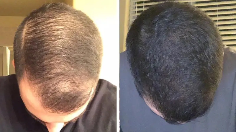 The results of using iRestore Professional for 5 months