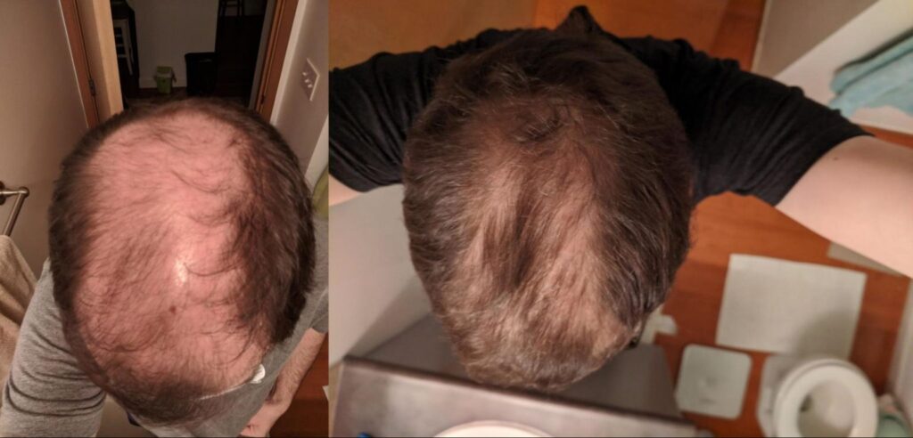 The results of using iRestore Professional for 6 months