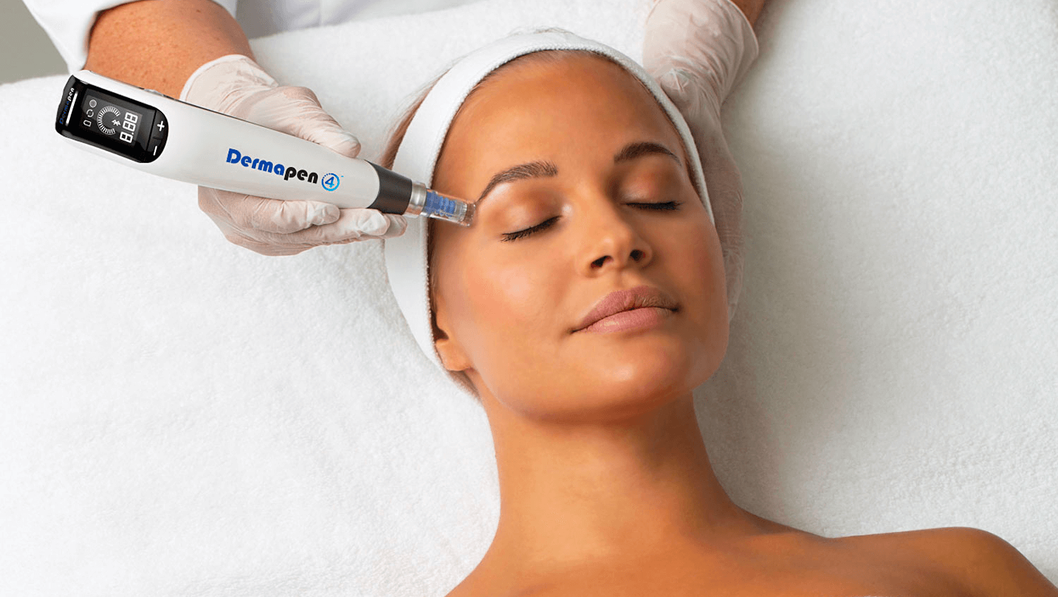 microneedling