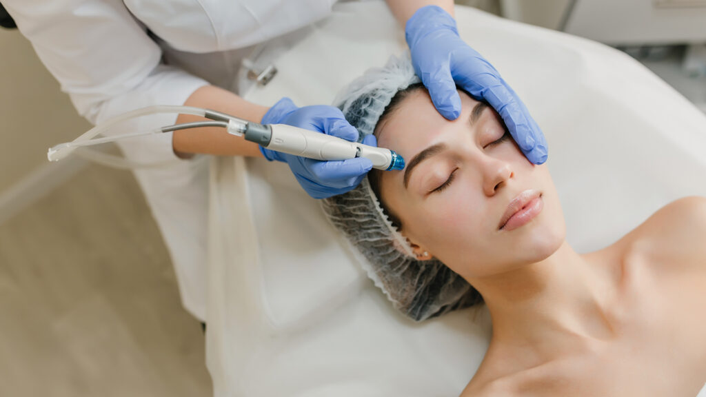 Microneedling