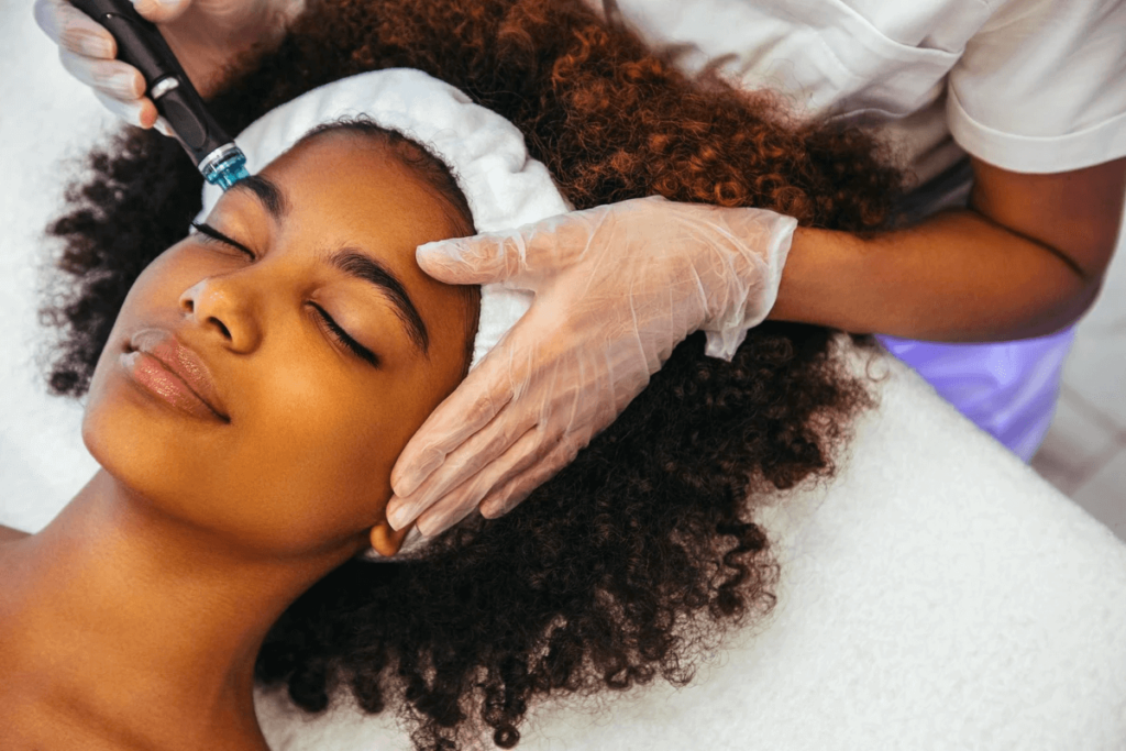 Does microneedling hurt