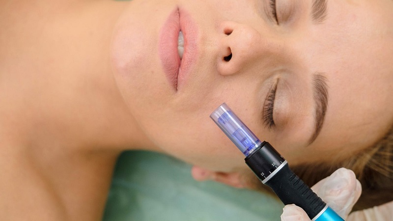 Microneedling pen